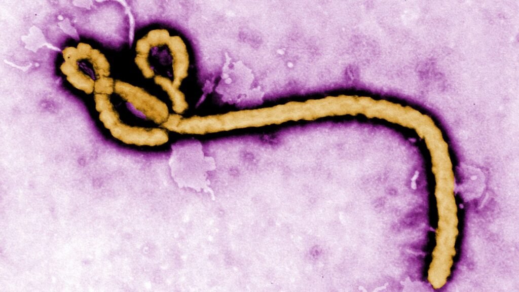 Ebola-Virus. Credits: CDC