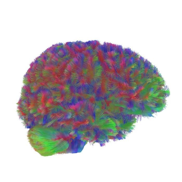Ein repräsentatives MRT-Traktographiebild der ersten Phase des menschlichen Gehirns. Dieses Bild ist repräsentativ für das allgemeine Muster, das in den Gehirnen der Studie während der ersten Phase der neuronalen Verschaltung zwischen null und neun Jahren beobachtet wurdeBildnachweis
Dr. Alexa Mousley, Universität Cambridge
