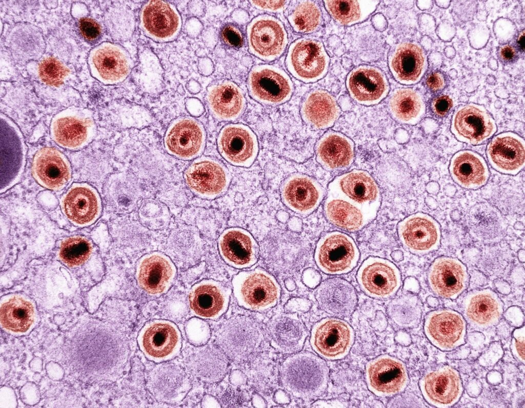 Originalpublikation:
S. Leusmann, E. Siebs, S. Kuhaudomlarp, A. Varrot, A. Imberty, B. Kuhn, C. Lerner, U. Grether, A. Titz. The Parkinson's Disease Drug Tolcapone and Analogues are Potent Glycomimetic Lectin Inhibitors of Pseudomonas aeruginosa LecA. Angew. Chem. Int. Ed. 2025, e202508864. DOI: 10.1002/anie.202508864
https://doi.org/10.1002/anie.202508864