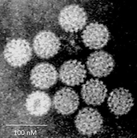 HPV Virus Credits Dr Graham Beards  CC BY SA 40