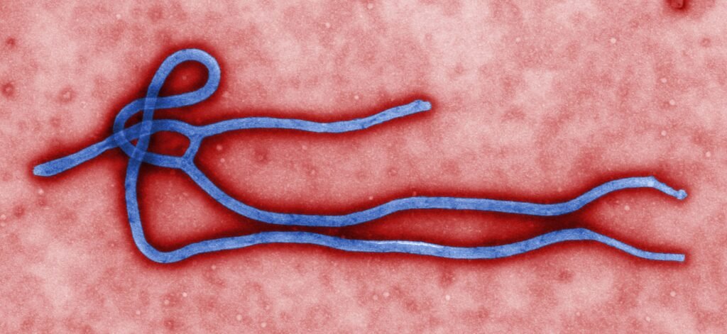 Cynthia Goldsmith / CDCThis colorized transmission electron micrograph (TEM) revealed some of the ultrastructural morphology displayed by an Ebola virus virion. See PHIL 1832 for a black and white version of this image.
