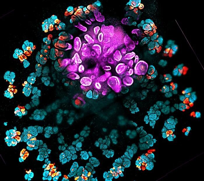 • LabNews AI Fluorescent microscopy rendering of a virus like particle with a pink central core and blue orange surrounding structures on a black background