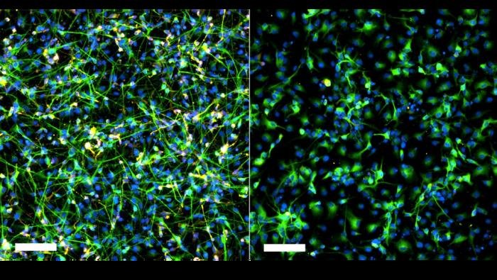 Side by side fluorescence images of cultured neural cells stained green for neurites and blue for nuclei left panel shows dense networks right panel shows a sparser network