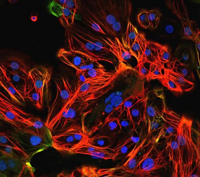 Protein PRDM16 steuert die Reifung menschlicher Herzmuskelzellen
