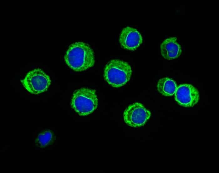 Fluorescent microscopy image of several green edged cells with blue nuclei against a black background