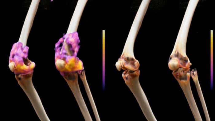 Animated illustration of knee joints along a leg with colorful pink and purple cartilage shown between bones against a black background