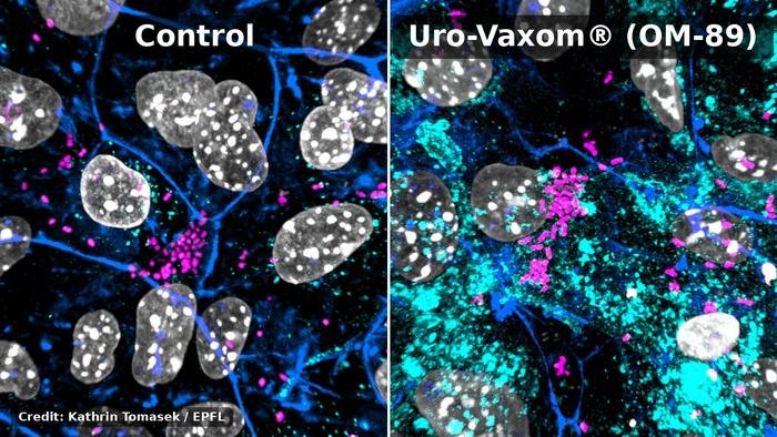 Split fluorescence microscopy image comparing control left with Uro Vaxom OM 89 treated sample right gray nuclei with white speckles bluecyan and magenta staining highlight cellular components